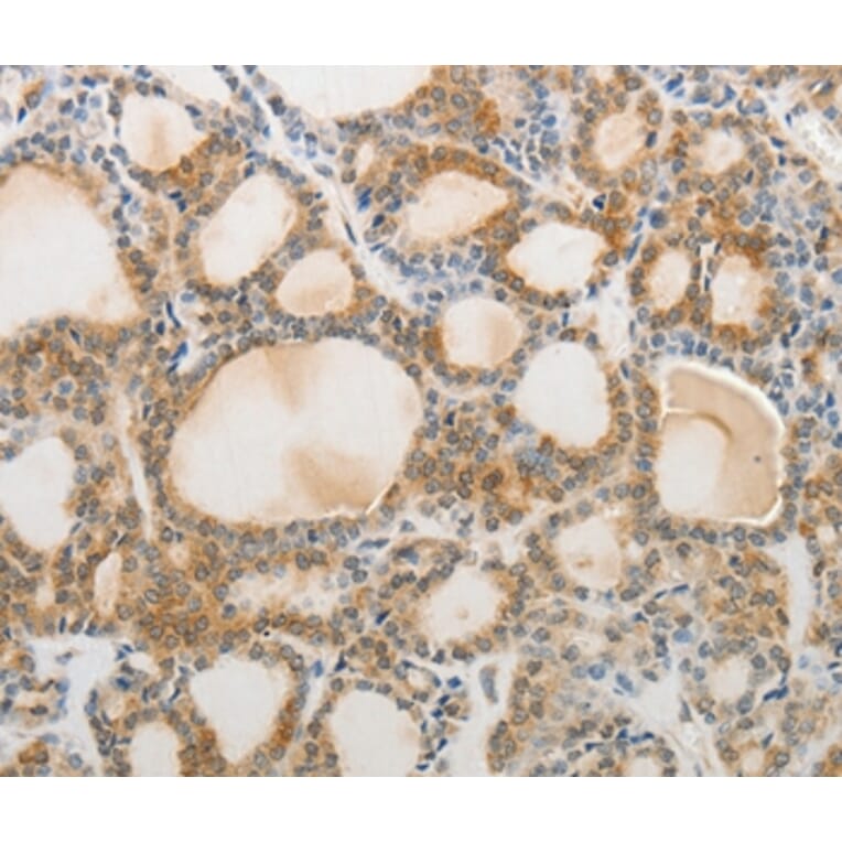 Immunohistochemistry - AKAP1 Antibody from Signalway Antibody (37094) - Antibodies.com