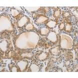 Immunohistochemistry - AKAP1 Antibody from Signalway Antibody (37094) - Antibodies.com
