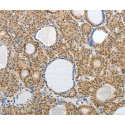 Immunohistochemistry - AKAP6 Antibody from Signalway Antibody (37095) - Antibodies.com