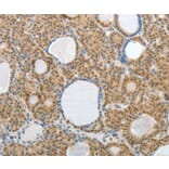 Immunohistochemistry - AKAP6 Antibody from Signalway Antibody (37095) - Antibodies.com