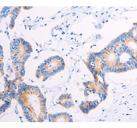 Immunohistochemistry - AGTR2 Antibody from Signalway Antibody (37100) - Antibodies.com