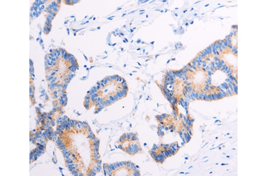 Immunohistochemistry - AGTR2 Antibody from Signalway Antibody (37100) - Antibodies.com