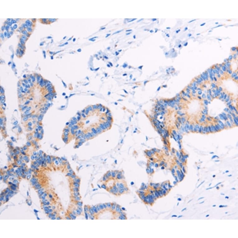 Immunohistochemistry - AGTR2 Antibody from Signalway Antibody (37100) - Antibodies.com