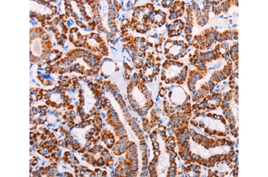 Immunohistochemistry - AGTR2 Antibody from Signalway Antibody (37100) - Antibodies.com