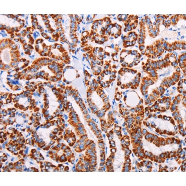 Immunohistochemistry - AGTR2 Antibody from Signalway Antibody (37100) - Antibodies.com