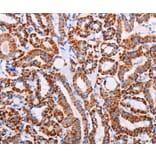 Immunohistochemistry - AGTR2 Antibody from Signalway Antibody (37100) - Antibodies.com