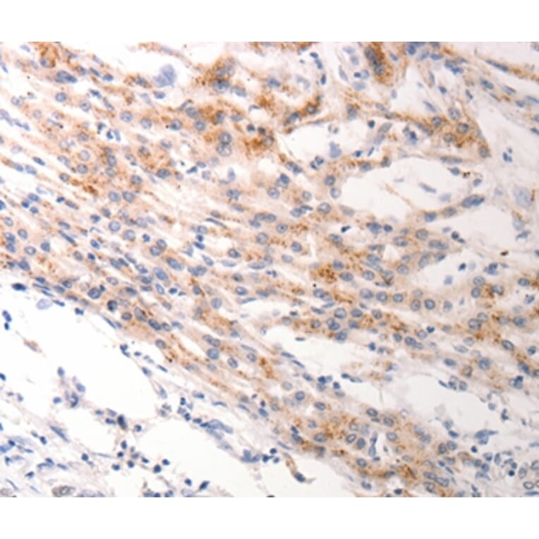 Immunohistochemistry - KRT6B Antibody from Signalway Antibody (37106) - Antibodies.com