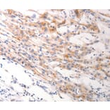 Immunohistochemistry - KRT6B Antibody from Signalway Antibody (37106) - Antibodies.com