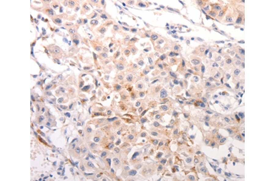 Immunohistochemistry - KRT6B Antibody from Signalway Antibody (37106) - Antibodies.com