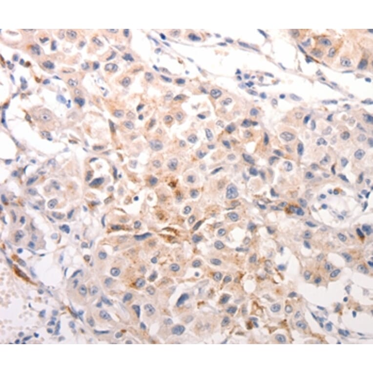 Immunohistochemistry - KRT6B Antibody from Signalway Antibody (37106) - Antibodies.com