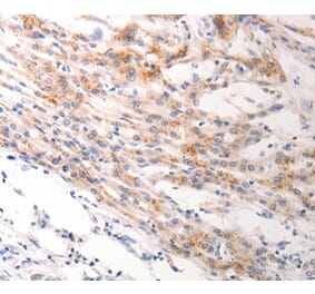 Immunohistochemistry - KRT6C Antibody from Signalway Antibody (37107) - Antibodies.com