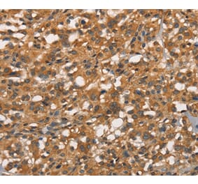 Immunohistochemistry - APOC4 Antibody from Signalway Antibody (37114) - Antibodies.com