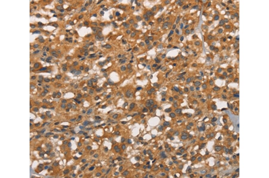 Immunohistochemistry - APOC4 Antibody from Signalway Antibody (37114) - Antibodies.com