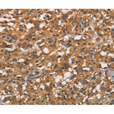 Immunohistochemistry - APOC4 Antibody from Signalway Antibody (37114) - Antibodies.com