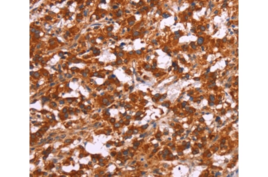 Immunohistochemistry - ARPC4 Antibody from Signalway Antibody (37116) - Antibodies.com