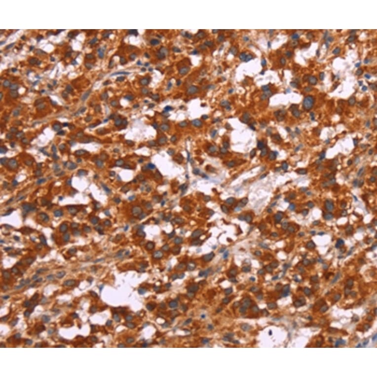 Immunohistochemistry - ARPC4 Antibody from Signalway Antibody (37116) - Antibodies.com