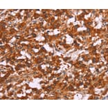 Immunohistochemistry - ARPC4 Antibody from Signalway Antibody (37116) - Antibodies.com