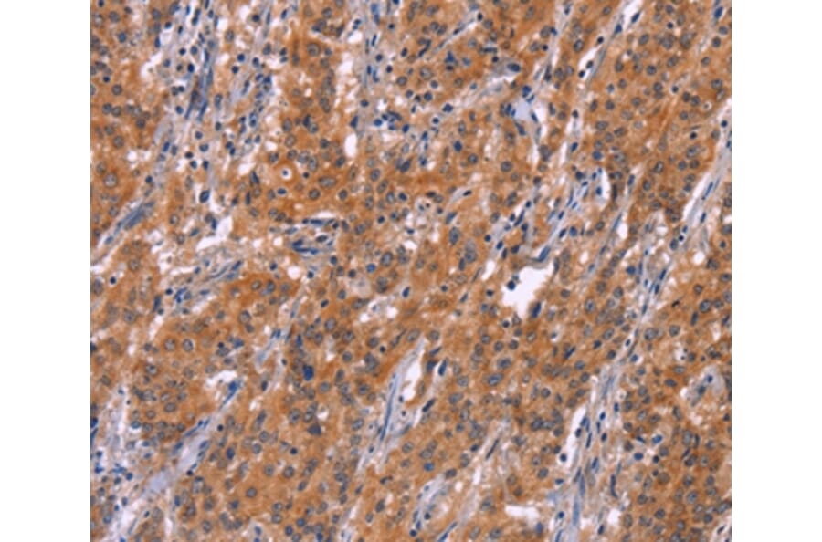 Immunohistochemistry - ARPC4 Antibody from Signalway Antibody (37116) - Antibodies.com