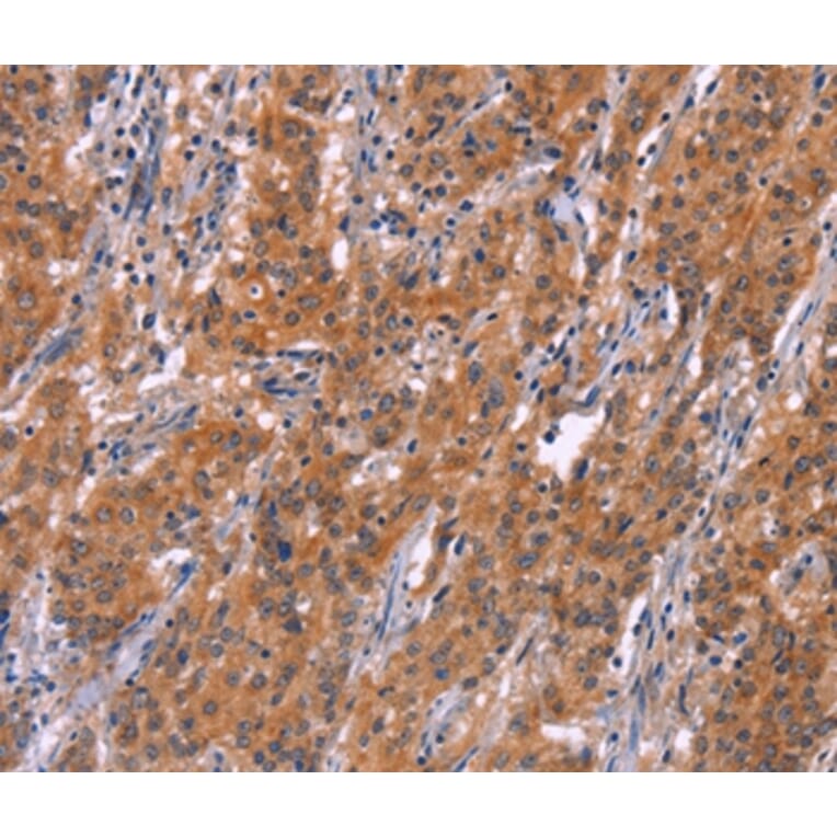 Immunohistochemistry - ARPC4 Antibody from Signalway Antibody (37116) - Antibodies.com