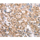 Immunohistochemistry - LATS2 Antibody from Signalway Antibody (37128) - Antibodies.com