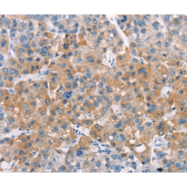 Immunohistochemistry - LATS2 Antibody from Signalway Antibody (37128) - Antibodies.com