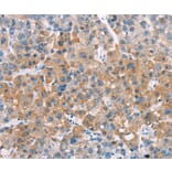 Immunohistochemistry - LATS2 Antibody from Signalway Antibody (37128) - Antibodies.com