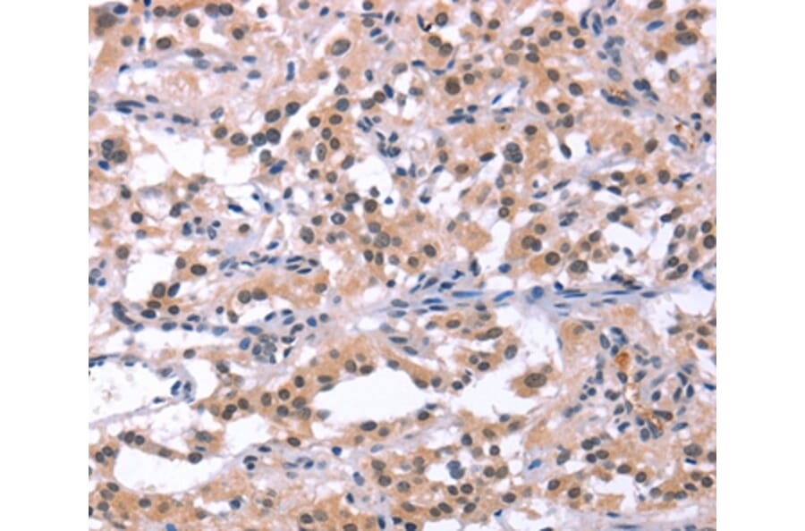 Immunohistochemistry - ORAI1 Antibody from Signalway Antibody (37133) - Antibodies.com