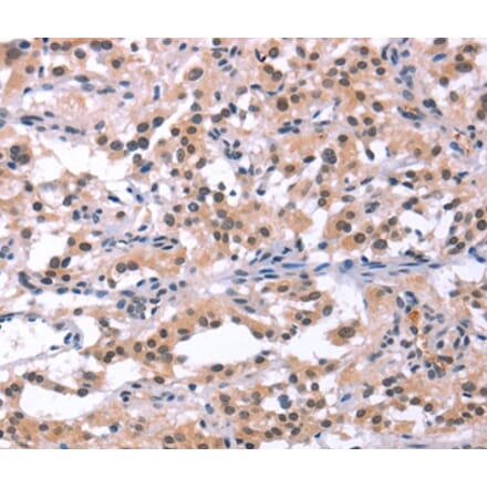 Immunohistochemistry - ORAI1 Antibody from Signalway Antibody (37133) - Antibodies.com