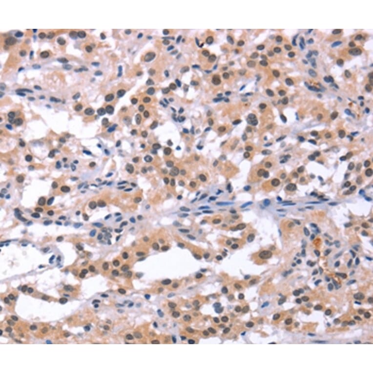 Immunohistochemistry - ORAI1 Antibody from Signalway Antibody (37133) - Antibodies.com
