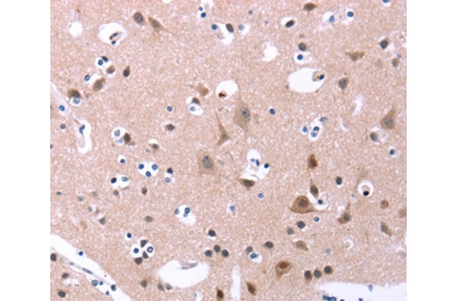 Immunohistochemistry - ORAI1 Antibody from Signalway Antibody (37133) - Antibodies.com