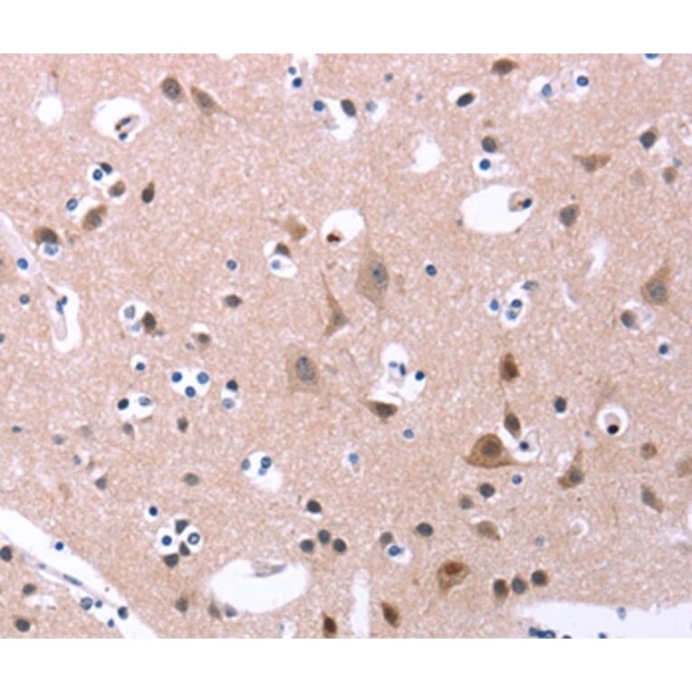 Immunohistochemistry - ORAI1 Antibody from Signalway Antibody (37133) - Antibodies.com