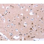 Immunohistochemistry - ORAI1 Antibody from Signalway Antibody (37133) - Antibodies.com