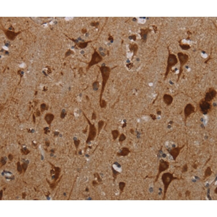Immunohistochemistry - KMT2D Antibody from Signalway Antibody (37139) - Antibodies.com