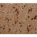 Immunohistochemistry - KMT2D Antibody from Signalway Antibody (37139) - Antibodies.com