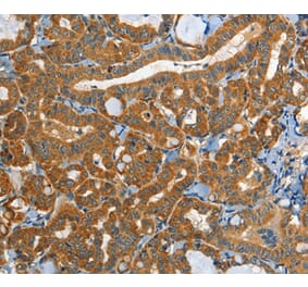 Immunohistochemistry - EPHB3 Antibody from Signalway Antibody (37140) - Antibodies.com