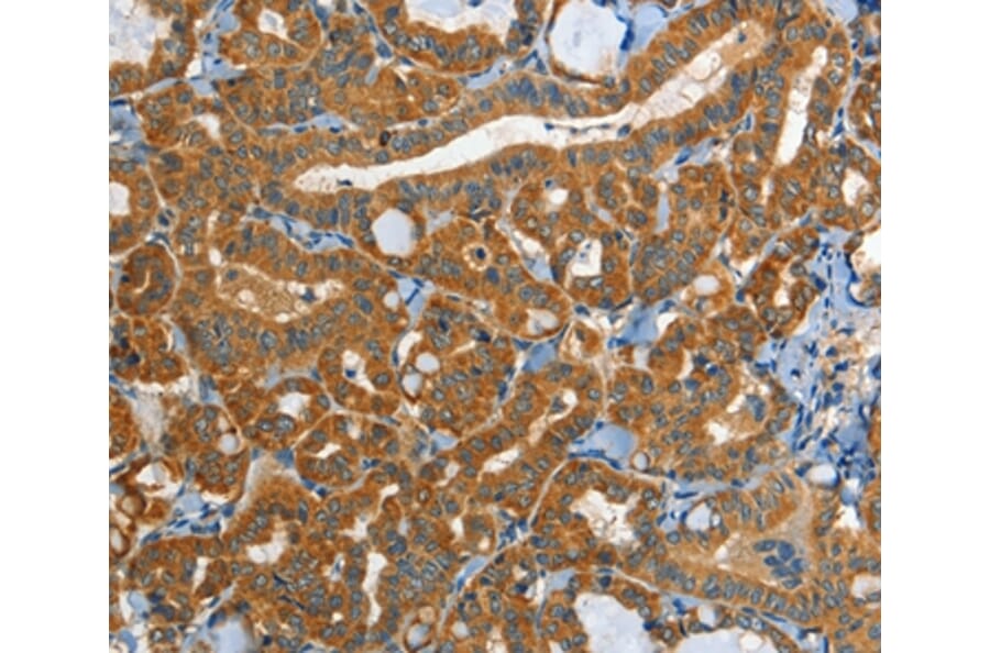 Immunohistochemistry - EPHB3 Antibody from Signalway Antibody (37140) - Antibodies.com