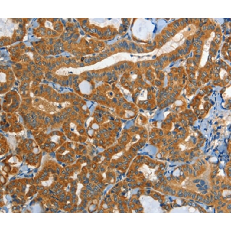 Immunohistochemistry - EPHB3 Antibody from Signalway Antibody (37140) - Antibodies.com