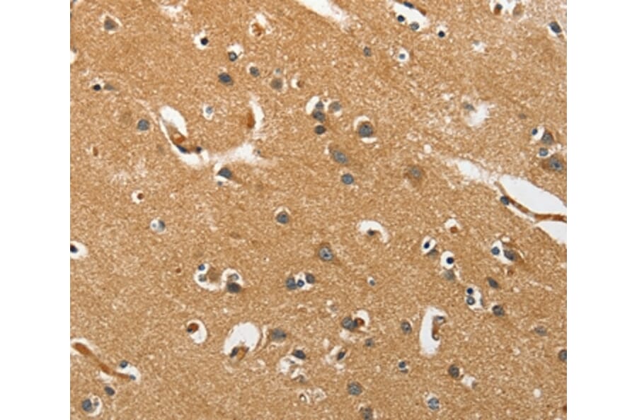 Immunohistochemistry - EPHB3 Antibody from Signalway Antibody (37140) - Antibodies.com