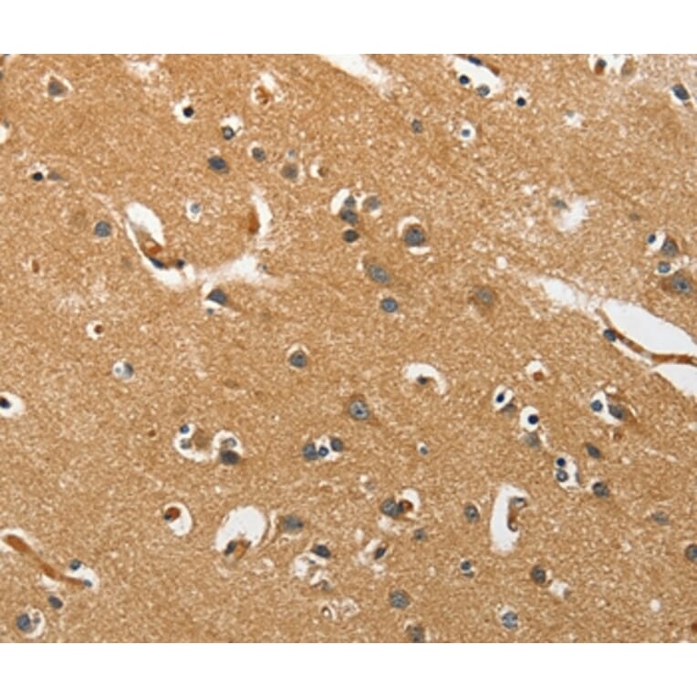 Immunohistochemistry - EPHB3 Antibody from Signalway Antibody (37140) - Antibodies.com