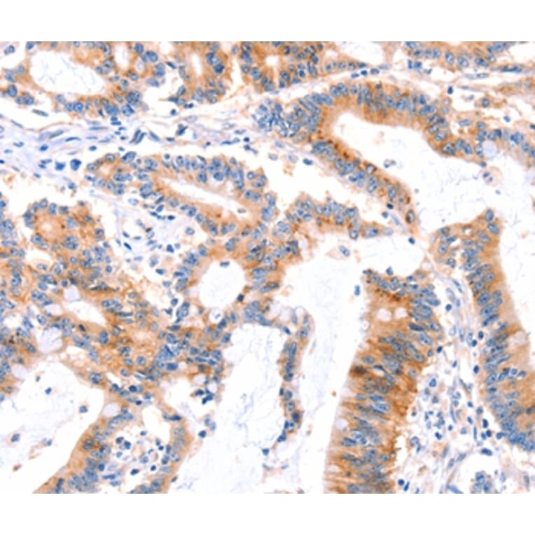 Immunohistochemistry - MLLT4 Antibody from Signalway Antibody (37144) - Antibodies.com