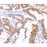 Immunohistochemistry - MLLT4 Antibody from Signalway Antibody (37144) - Antibodies.com