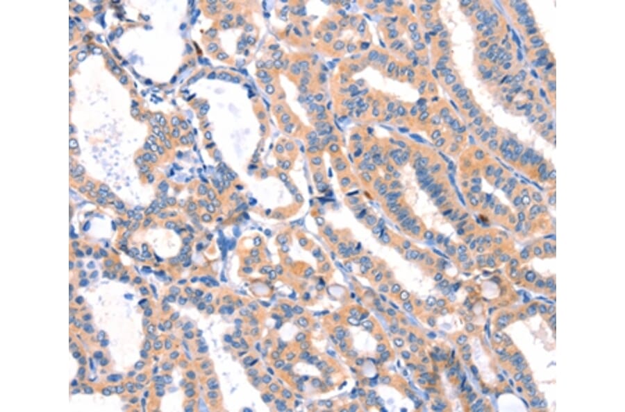 Immunohistochemistry - MLLT4 Antibody from Signalway Antibody (37144) - Antibodies.com