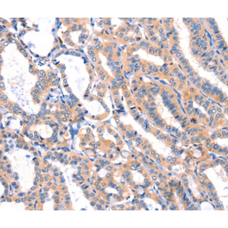 Immunohistochemistry - MLLT4 Antibody from Signalway Antibody (37144) - Antibodies.com