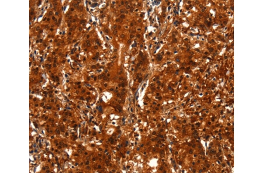 Immunohistochemistry - BCAS3 Antibody from Signalway Antibody (37148) - Antibodies.com