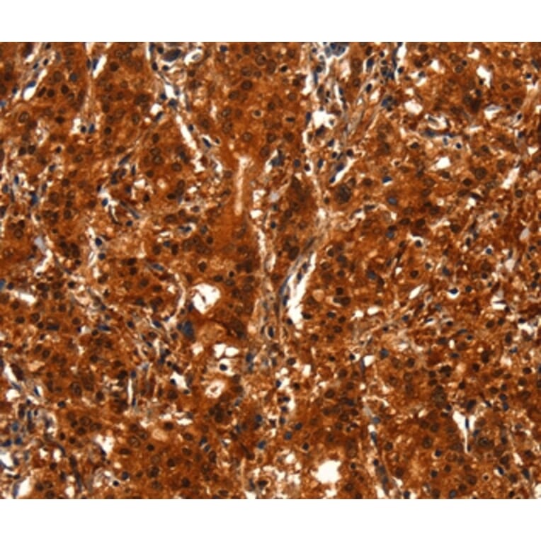 Immunohistochemistry - BCAS3 Antibody from Signalway Antibody (37148) - Antibodies.com