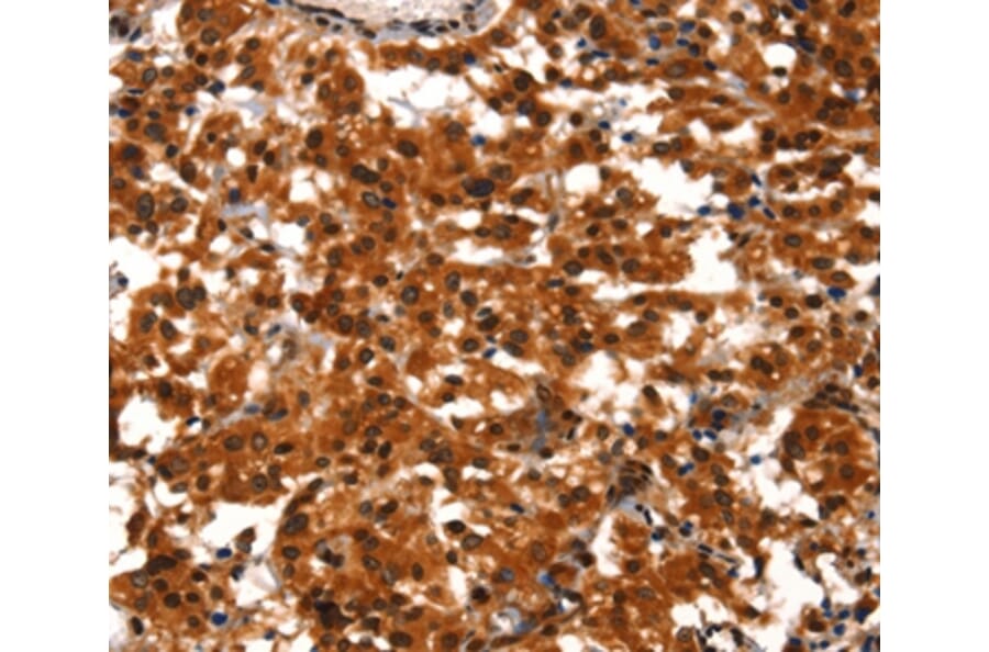 Immunohistochemistry - BCAS3 Antibody from Signalway Antibody (37148) - Antibodies.com