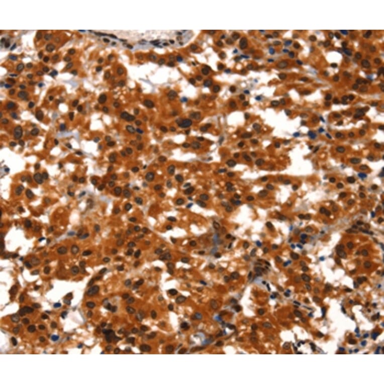 Immunohistochemistry - BCAS3 Antibody from Signalway Antibody (37148) - Antibodies.com