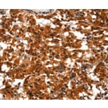 Immunohistochemistry - BCAS3 Antibody from Signalway Antibody (37148) - Antibodies.com