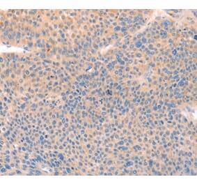 Immunohistochemistry - CD109 Antibody from Signalway Antibody (37154) - Antibodies.com