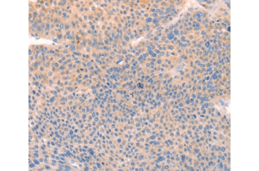 Immunohistochemistry - CD109 Antibody from Signalway Antibody (37154) - Antibodies.com